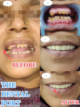 Slider image (6) THE DENTAL PORT